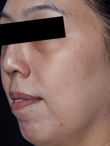 外箱シミあります 6-7863-02 導電パーツボックス No.2L 780548 【AXEL】 アズワン